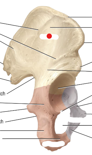 <p>Identify the structure pinned</p>