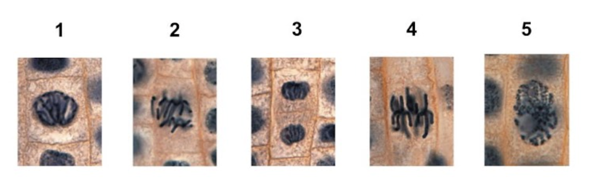 <p><span>45. Observe the micrographs of the onion root tip below. Which of the following places the images in the correct order of mitosis?</span></p><p><span style="line-height: 1.5;">A. 1 = Prophase, 2 = Pro-metaphase, 3 = Metaphase, 4 = Anaphase, 5 = Telophase</span></p><p><span style="line-height: 1.5;">B. 1 = Anaphase, 2 = Metaphase, 3 = Pro-metaphase, 4 = Telophase, 5 = Prophase</span></p><p><span style="line-height: 1.5;">C. 1 = Pro-metaphase, 2 = Anaphase, 3 = Telophase, 4 = Metaphase, 5 = Prophase</span> </p><p><span style="line-height: 1.5;">D. 1 = Metaphase, 2 = Pro-metaphase, 3 = Prophase, 4 = Anaphase, 5 = Telophase</span></p>