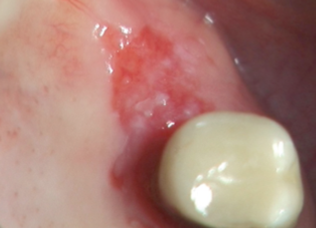 <p>what is this condition</p>