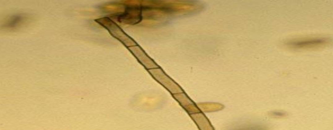 <p>Specimen (microscopically slide):</p><p>• Name of organism:</p><p>• Stain:</p><p>• Sample from: culture or pus or in tissue</p><p>• Morphology</p>