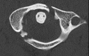 <p>what is the diagnosis?</p>