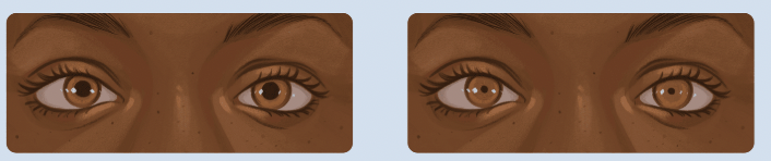 <p>What is the effect of activating Mu (μ) receptor?</p>