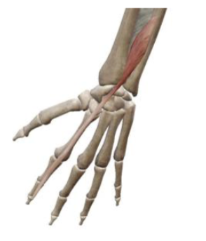 <p>what muscle and action is this </p>