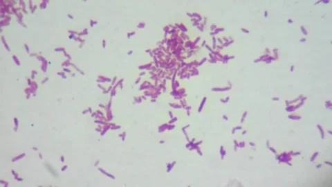 <ul><li><p><span><strong>Shape:</strong> Straight rods (bacilli) with rounded ends, typically \(1.0 - 2.0\:\mu\text{m}\) in length and \(0.5\:\mu\text{m}\) in width.</span></p></li><li><p><span><strong>Arrangement:</strong> Occur singly or in pairs.</span></p></li><li><p><span><strong>Motility:</strong> Most strains are motile via peritrichous flagella, though some non-motile variants exist.</span></p></li><li><p><span><strong>Structures:</strong> Possesses pili (fimbriae) for adhesion and may have a capsule.</span> [1, 2, 3, 4, 5]</p></li></ul><p></p>