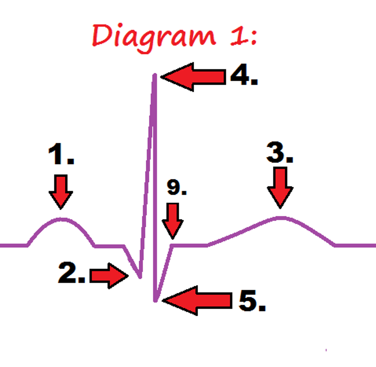 <p>p wave , t wave, r wave, s, wave, q wave</p>