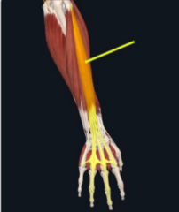 <p>Extends fingers and the wrist</p>