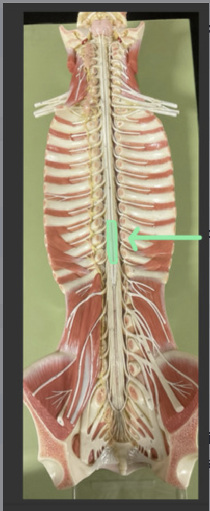 <p>spinal cord region corresponding to lower extremity spinal nerves</p>