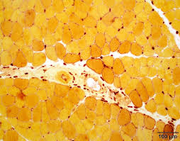 <p>alpha naphthyl acetate esterase results:</p><p>brick red:</p><p>pale yellow:</p><p>dark red-brown:</p>