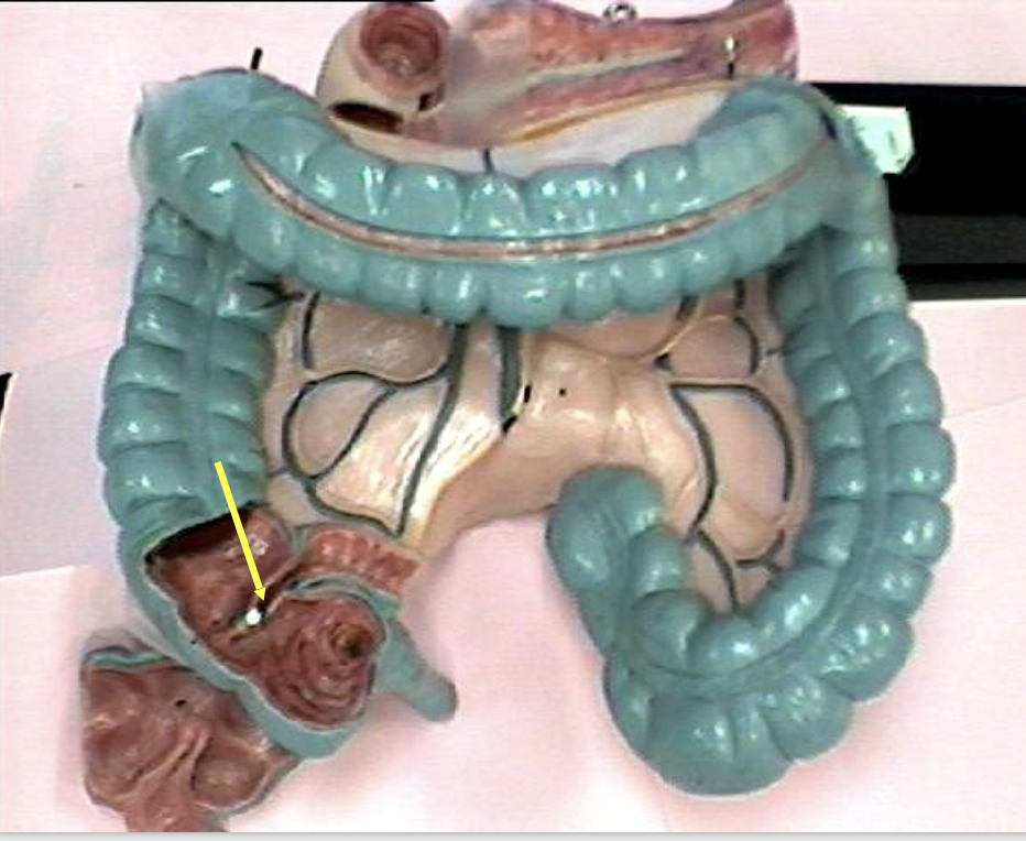 <p>Identify the organ.</p>
