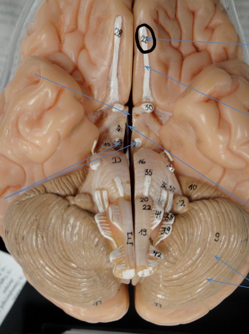 <p>Identify the circled area?</p>
