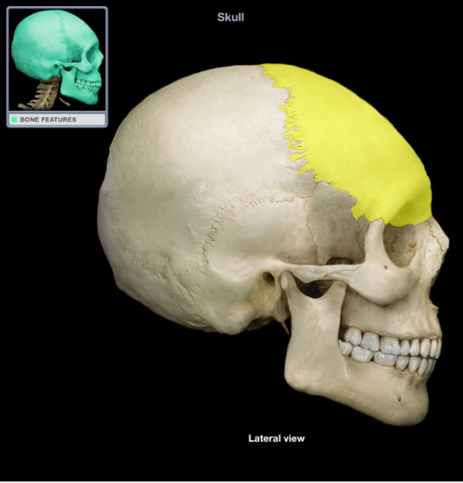 term image