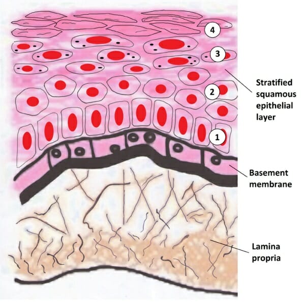 <p>Multiple layers Flat, irregular cells</p>