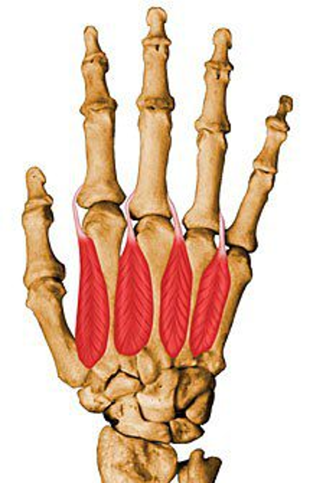 <p>what muscle is this?</p>