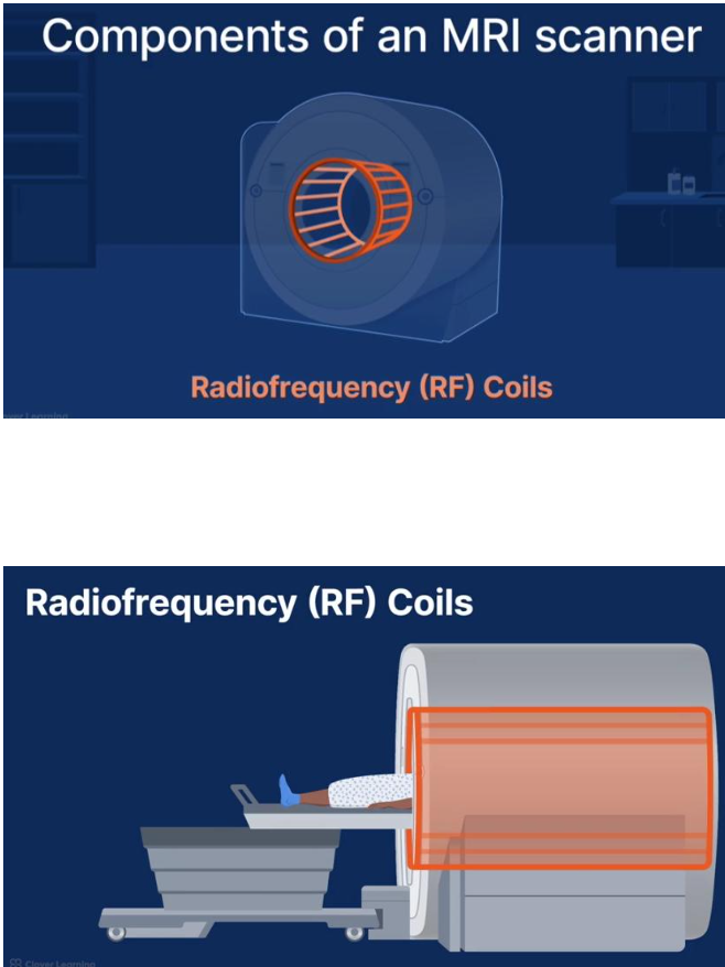 <p><strong>Radiofrequency (RF) coils</strong> are specialised antennas used to transmit and/or receive radiofrequency energy during MRI.</p><p>Their functions are to:</p><ul><li><p>transmit RF energy into the patient,</p></li><li><p>excite hydrogen nuclei,</p></li><li><p>receive the RF signal emitted during relaxation,</p></li><li><p>convert RF energy into electrical signals,</p></li><li><p>send these signals to the computer for image reconstruction.</p></li></ul><p>Without RF coils, MRI images cannot be produced.</p>