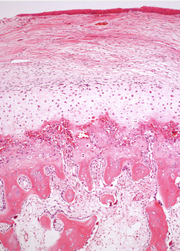 <p>tumeur sous l’ongle </p><p>1) diagnostic</p><p>2) moléculaire</p>