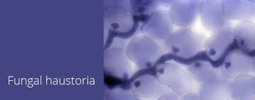 <p><span>branched hyphal structures that penetrate host plant cell walls—but not the plasma membrane</span></p><p><mark data-color="rgba(0, 0, 0, 0)" style="background-color: rgba(0, 0, 0, 0); color: inherit;">feeding, metabolic manipulation of the host, and delivering effector proteins to suppress host defenses</mark><span>.</span></p><ul><li><p><span>Rust fungi</span></p></li><li><p><span>Powdery mildews</span></p></li><li><p><span>Downy mildews</span></p></li><li><p><span>Other parasitic pathogens</span></p></li></ul><p></p>