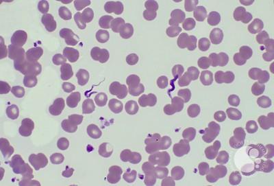 <ol><li><p>is this a protist or a bacteria?</p></li><li><p>what phylum?</p></li><li><p>what disease does this cause?</p></li></ol><p></p>