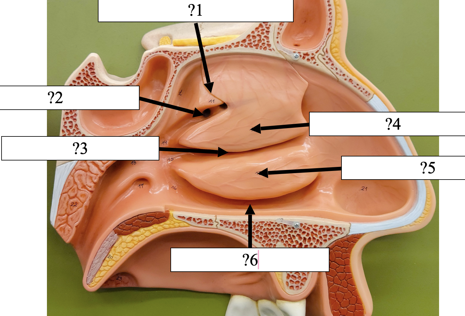<p>6 Name the groove?</p>