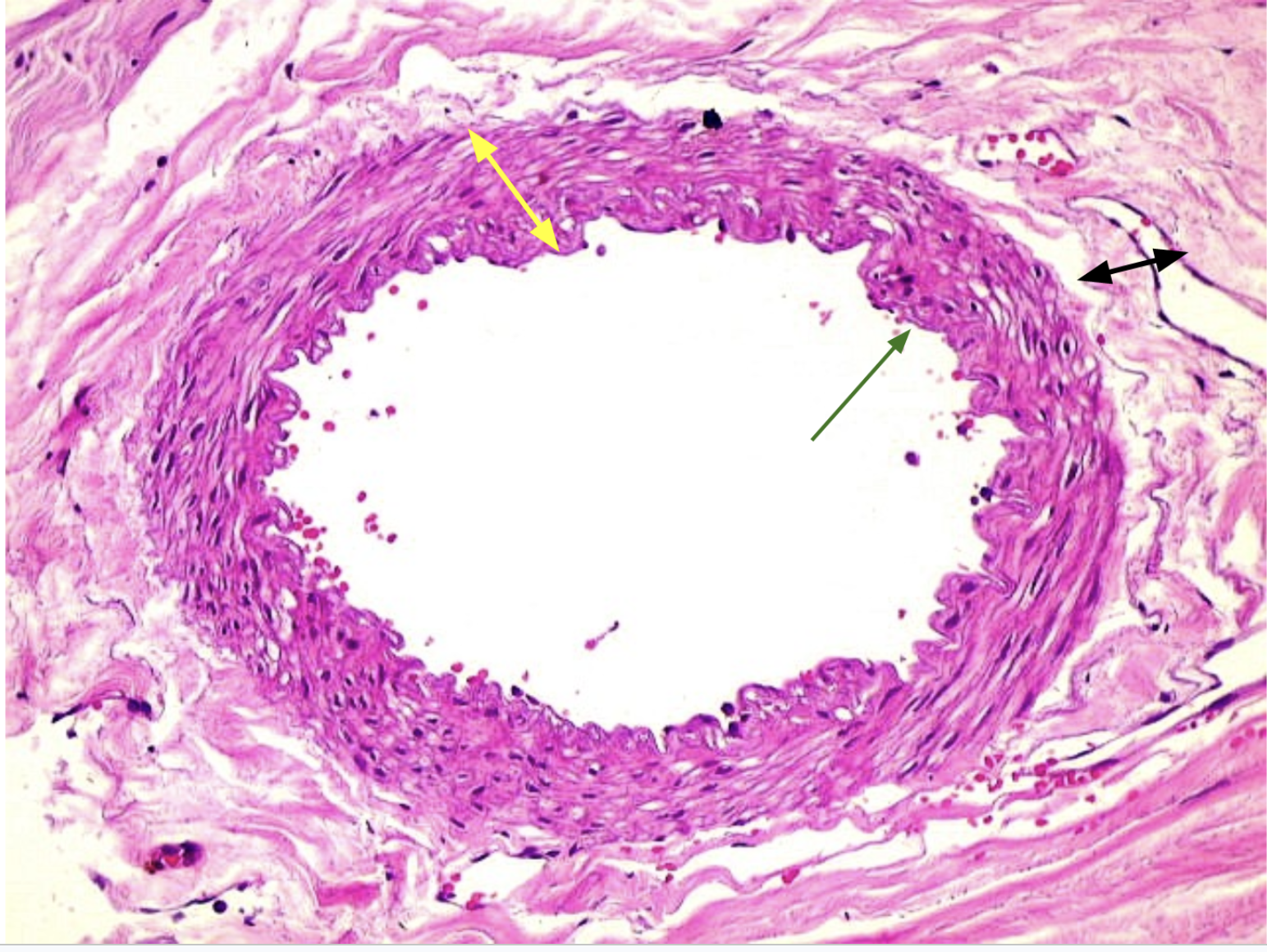<p>Is this a vein or an artery? Identify the layers labeled by the arrows</p><p>The middle hole of the vessel is called what?</p>