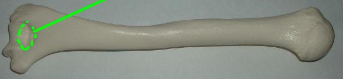 <p>largest fossa of the three (tells left v right)</p>