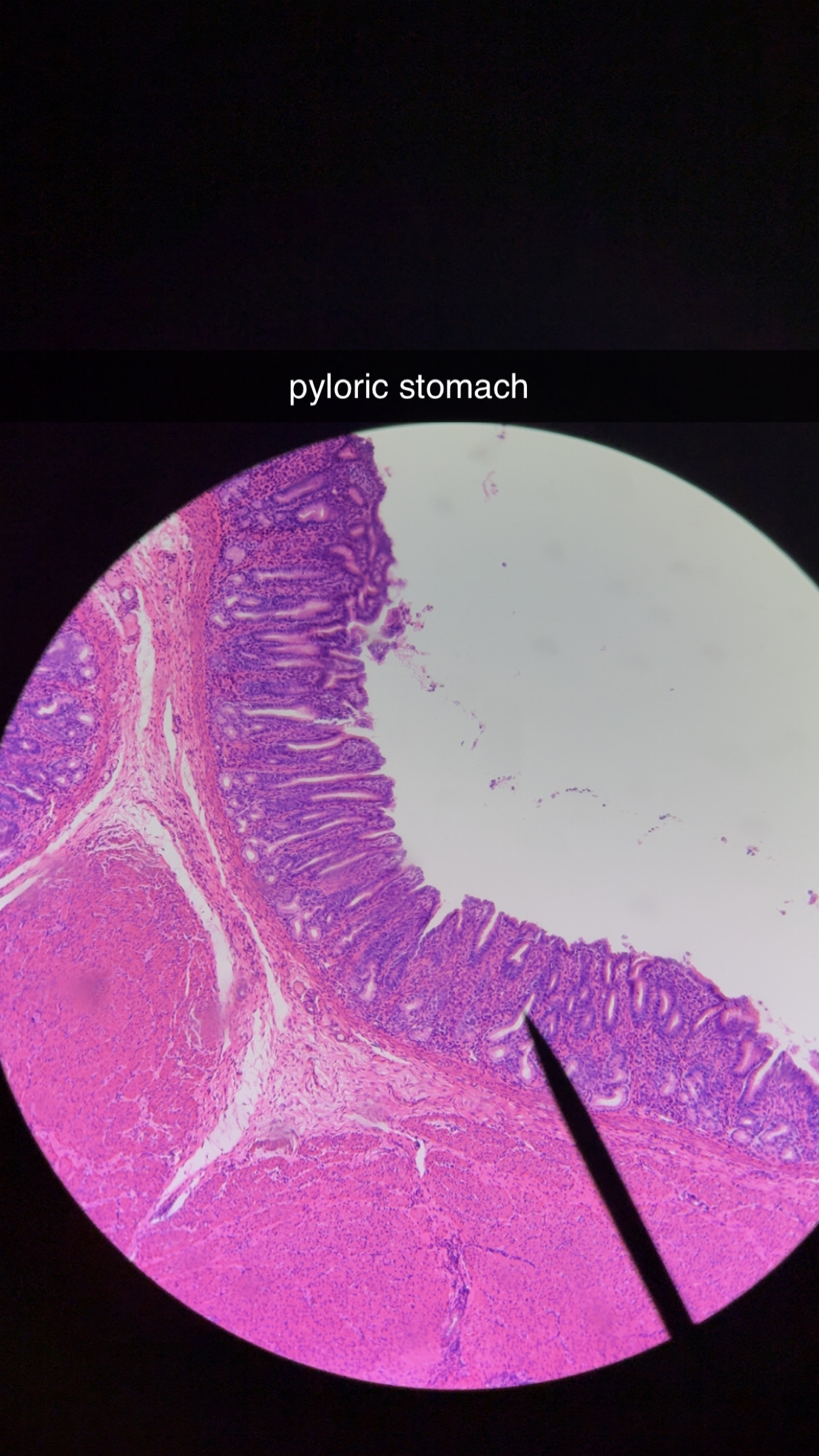 <p>stomach exits into duodenum </p><p></p><p>most digestive activity occurs here </p><p></p><p>has deep gastric pits and glands</p>