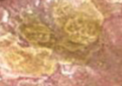 <p>plaques</p>
