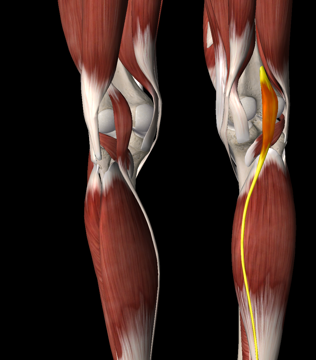 <p>What muscle is this?</p>
