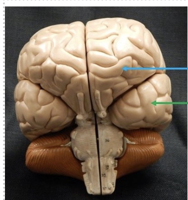 <p>what is the green line? (lobe)</p>