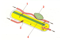 <p>Pupil fibres of oculomotor nerve are located superiorly early in path; vulnerable to effects of what?</p>