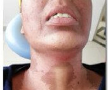 <p>CHẨN ĐOÁN?</p>