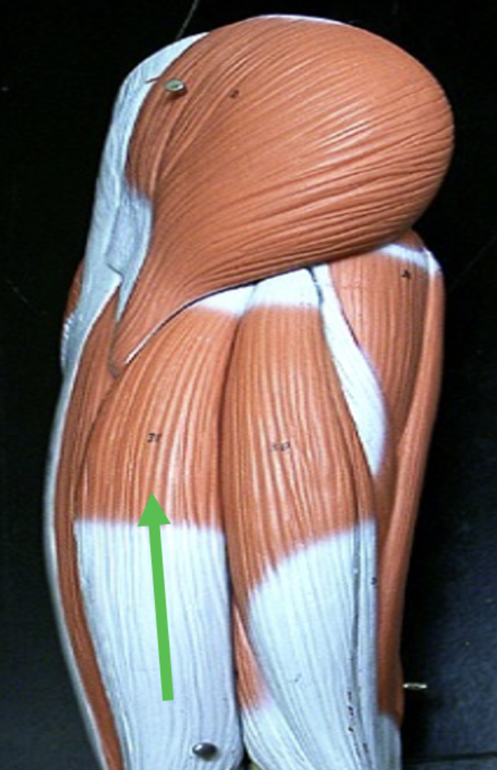<p>Identify the muscle indicated by the pointer.</p>