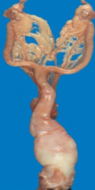 <p>Whose uterus is this?</p>