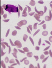 <p>What mammal would you likely see these red blood cells in vitro?</p>