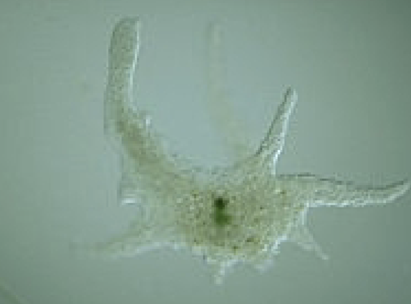 <p>What protist is this? (genus name)</p>