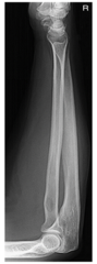 <p>Lateral Forearm- Evaluation Criteria</p>