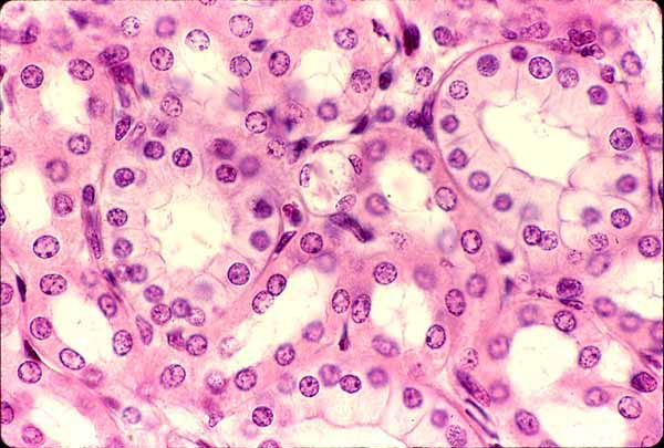 <p>is located in the kidney tubules</p>