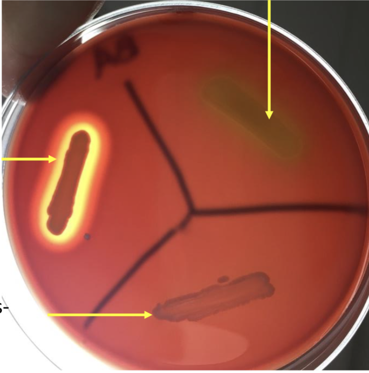 <p>what is the left top line with yellow around?</p>
