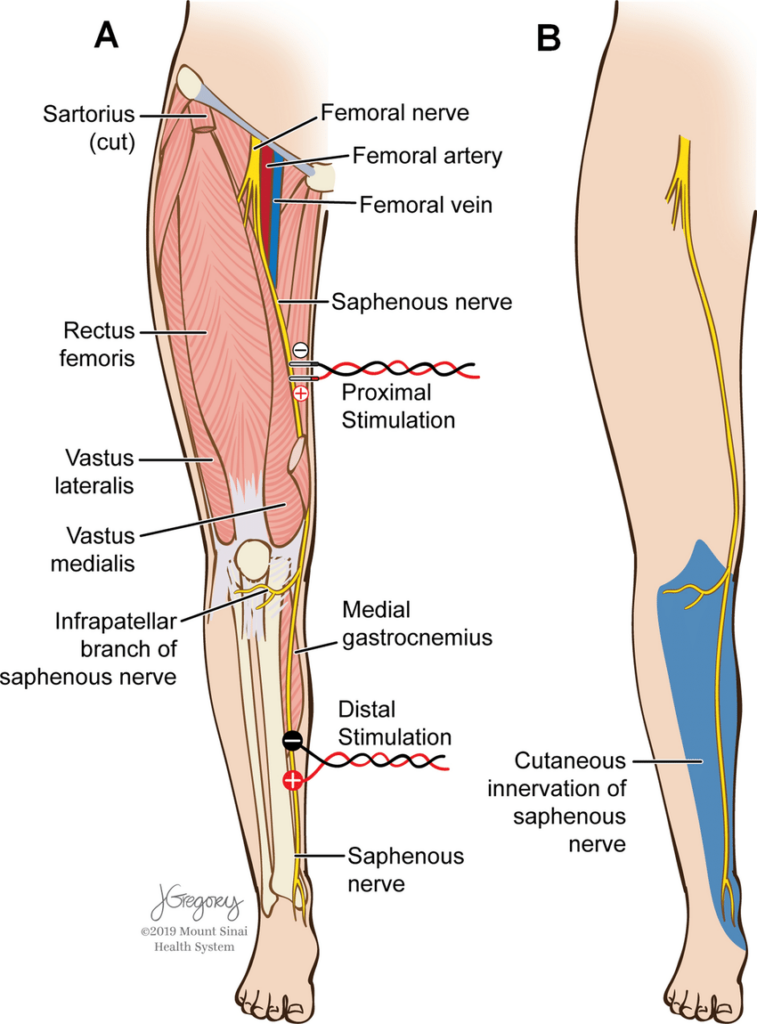 <p>Terminal branch of femoral nerve; leaves femoral canal in the triangle, descends in adductor canal deep to sartorius with the superficial femoral artery</p>