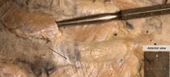 <p>superficial to muscle</p>