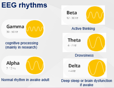 <ul><li><p><span>Frequency band - how fast the waves are</span></p></li><li><p><span>Morphology - shape</span></p></li><li><p><span>Topography - where on scalp</span></p></li><li><p><span>Amplitude - how tall the waves are</span></p></li><li><p><span>Reactivity - response to simulation</span></p></li><li><p><span>Symmetry</span></p></li></ul><p></p>