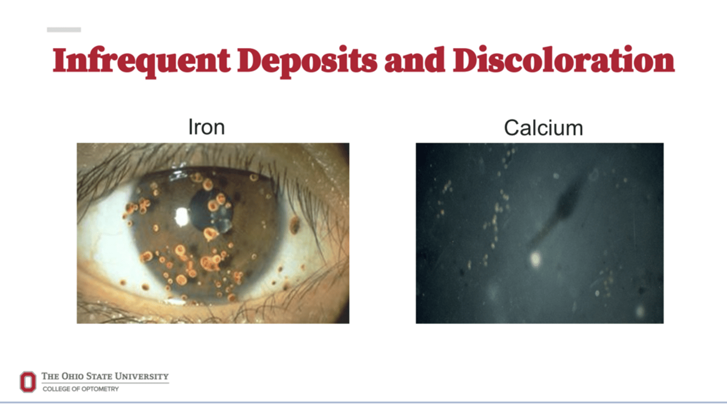 <p>Iron and Calcium Deposits (Pic)</p>
