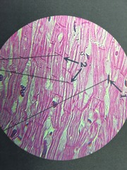 <p>Intercalated discs stained pink,red</p><p>Nucleus is dark dot</p>