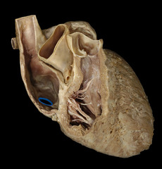 <p>identify the structure</p>