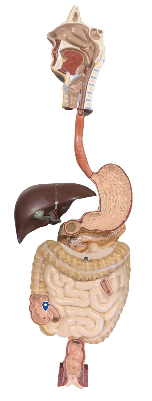 <p>Name this opening.</p>