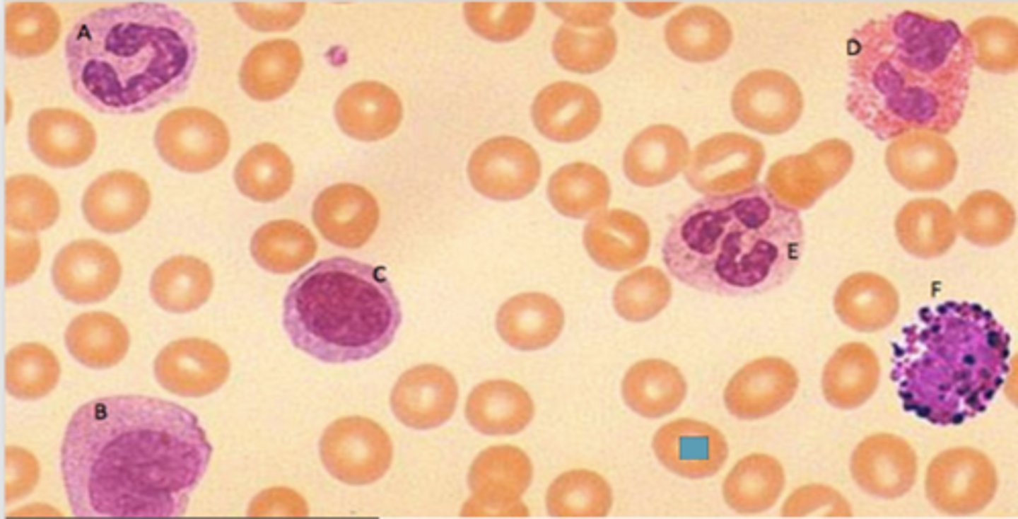 <p>Identify the following blood-formed element</p>