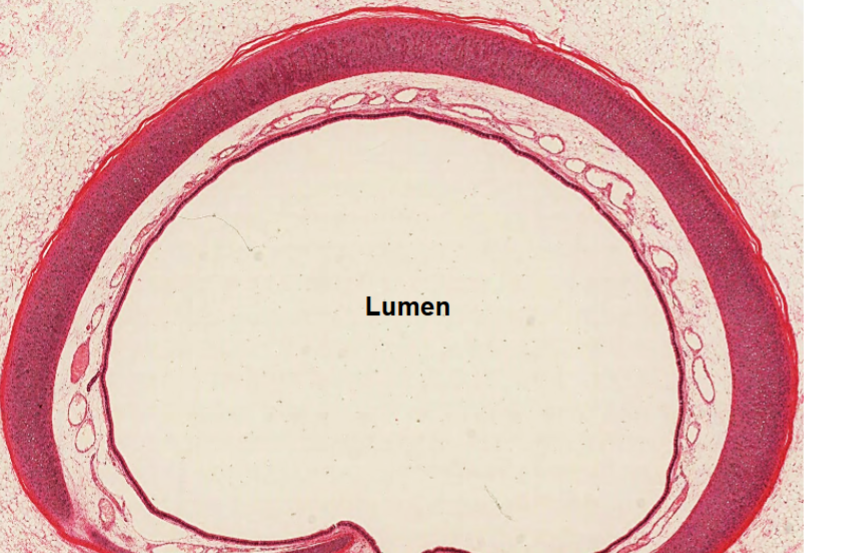 <p>Describe and point out the location of the trachealis muscle</p>