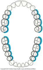 <p>10:00 to 11:00</p><p>Chin up</p><p>Head is toward the clinician.</p>