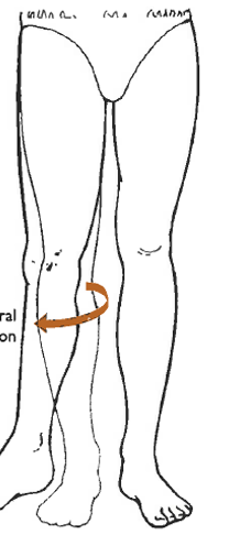 <p>What is this motion?</p>