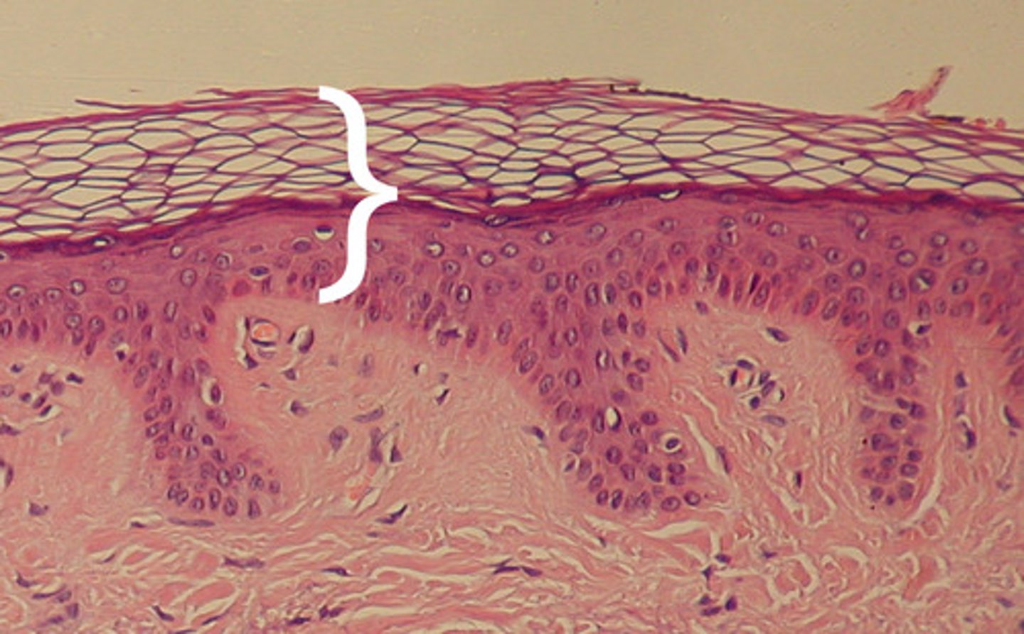 <p>The outer layer of skin, which is made up of cells that are sealed together to form a watertight protective covering for the body.</p>