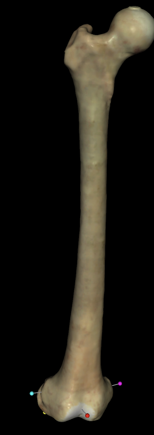 <p>what is the baby blue tag on the right femurs?</p>